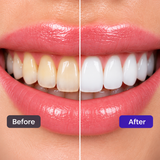 Hismile V34 Teeth Whitening Serum – Purple Colour Corrector