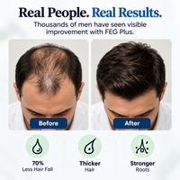 FEG Plus Hair Growth Spray 50ml – Men & Women