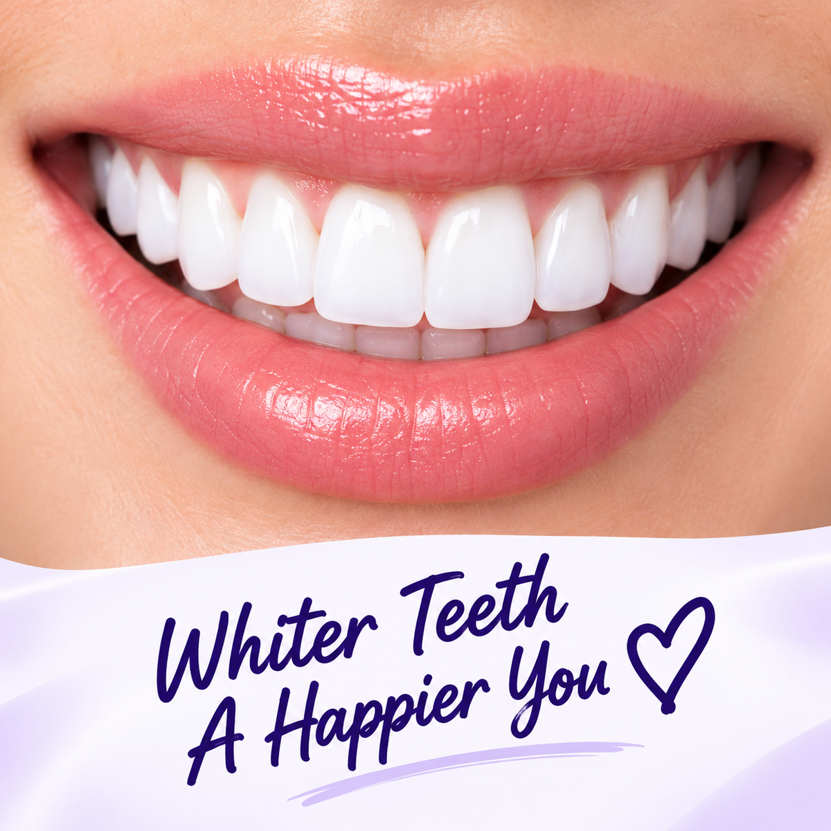 Hismile V34 Teeth Whitening Serum – Purple Colour Corrector